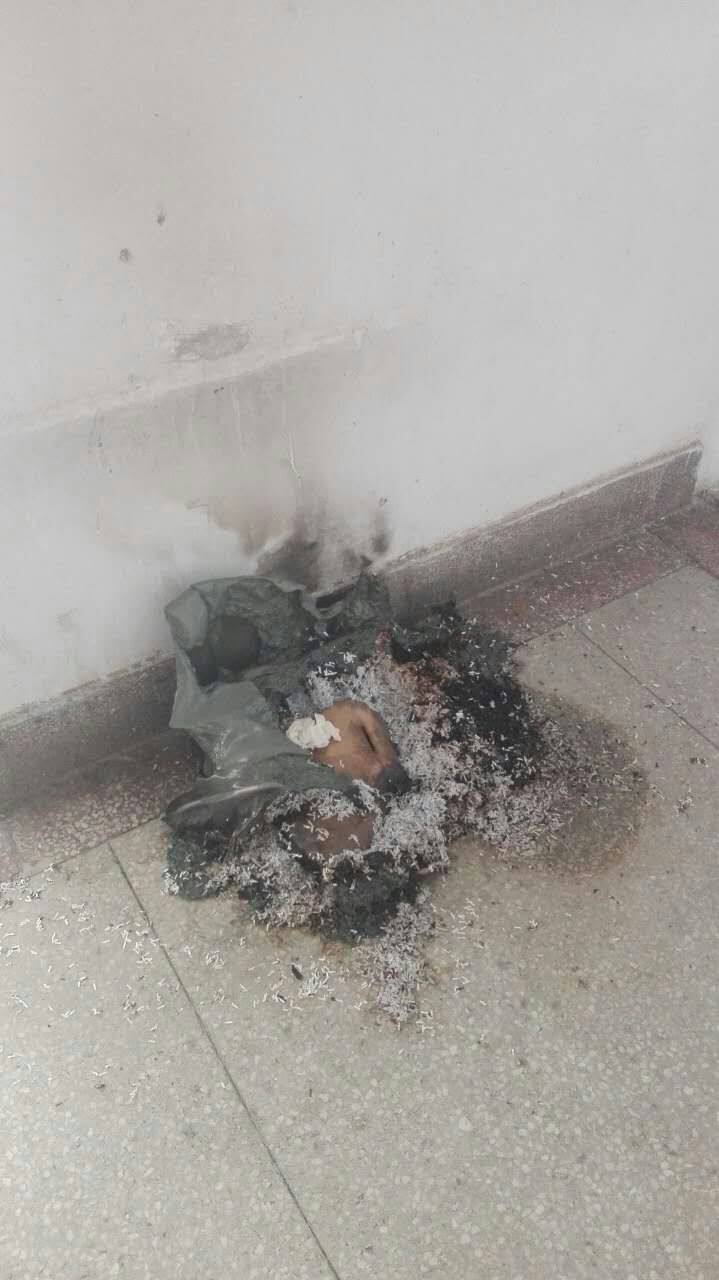 我院因烟头引发火灾被火苗“吞噬”的垃圾桶现场惨状